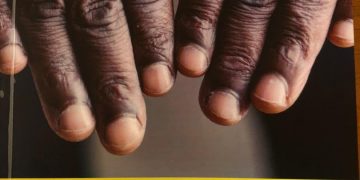 Teso Cultural Group to Join Fight against Human Trafficking