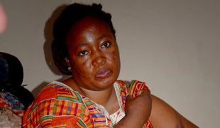 UPDF Dismiss NUP Supporter Marinos Torture Claims