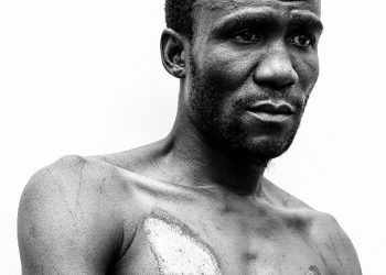 NUP Parading Fake Torture Victims- UPDF