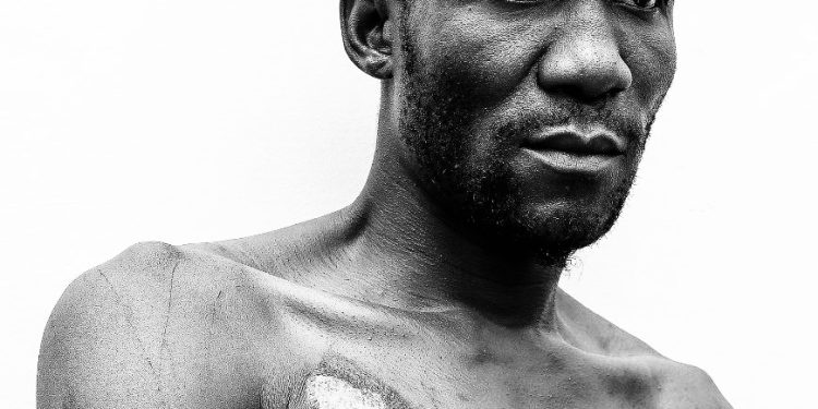 NUP Parading Fake Torture Victims- UPDF